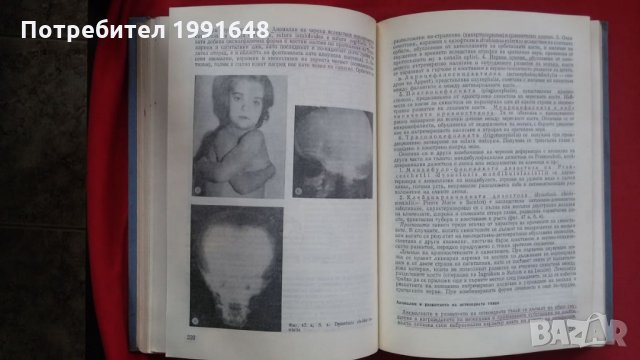 Книги за медицина: „Клинична педиатрия“ 2 част – проф. Бр.Братанов – народен деятел на науката, снимка 18 - Учебници, учебни тетрадки - 23999681