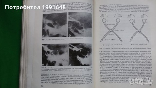 Книги за медицина: „Ръководство по вътрешни болести“ II том – под редакцията на акад.Т.Ташев и др., снимка 15 - Учебници, учебни тетрадки - 23038865