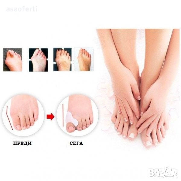 Силиконови разделители срещу изпъкнали кокалчета Footmate, снимка 1