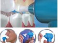 Luma Smile - ултразвукова система за безопасно и експресно почистване, избелване и полиране на зъбни, снимка 3