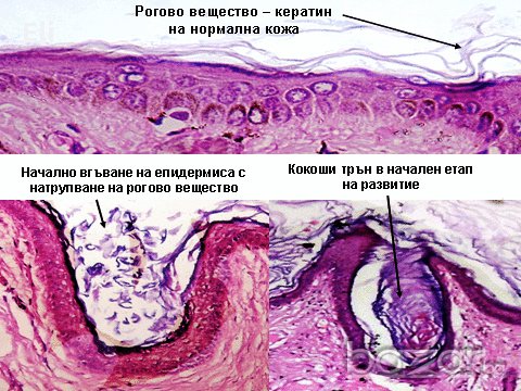 Мехлем-чудо за кокоши трън , снимка 3 - Козметика за тяло - 17283825