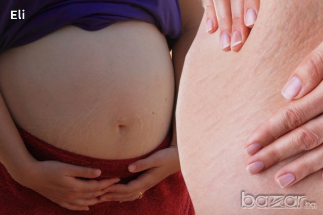 100%Натурален крем за бременни против стрии