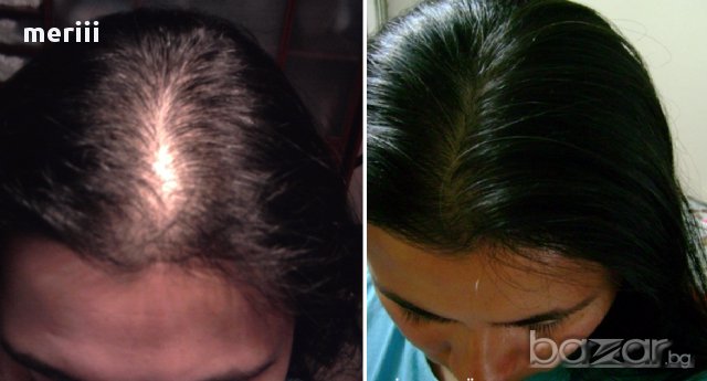 Моментално спиране на косопада!Масло за коса, снимка 1