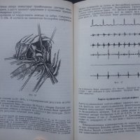 Книги за медицина: „Вродени пороци на кръвоносните съдове“ – доц. Стефан Белов, к.м.н., снимка 14 - Специализирана литература - 24403001