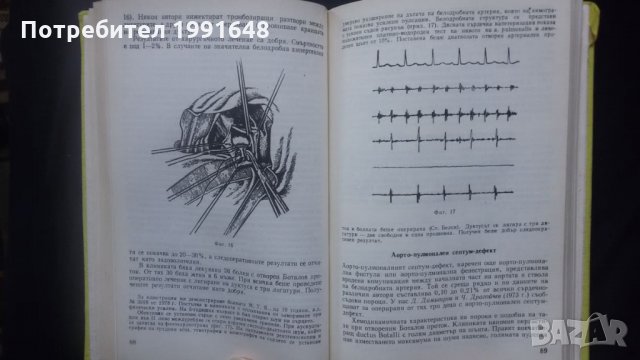 Книги за медицина: „Вродени пороци на кръвоносните съдове“ – доц. Стефан Белов, к.м.н., снимка 14 - Специализирана литература - 24403001