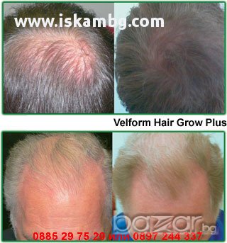 Лазерна четка за косопад Power Grow Comb - код 0286, снимка 5 - Аксесоари за коса - 12291878