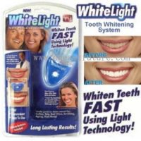 Систeма за избелване на зъби White Light, снимка 1 - Други - 10045041