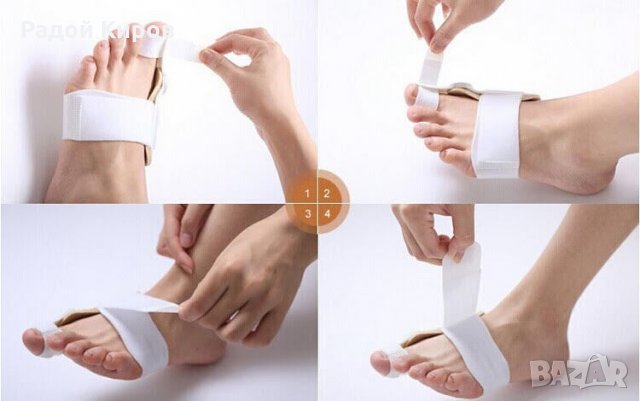 Олекотена нощна ортеза с подвижен механизъм за палеца на крака, снимка 6 - Други - 22817296