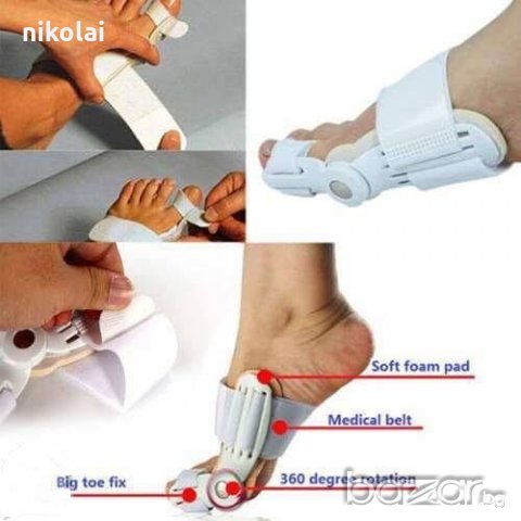 Ортеза за рехабилитация на изпъкнало кокалче на крака, снимка 1