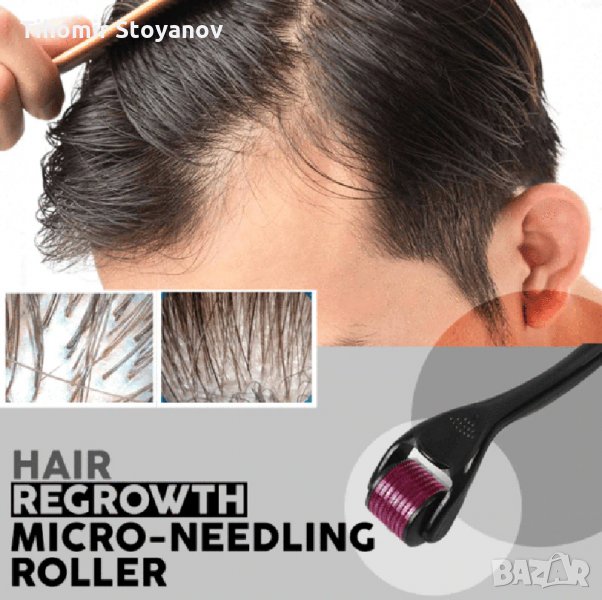 Ролер против косопад за домашна употреба Стимулира Разтеж, снимка 1