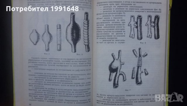 Книги за медицина: „Вродени пороци на кръвоносните съдове“ – доц. Стефан Белов, к.м.н., снимка 8 - Специализирана литература - 24403001