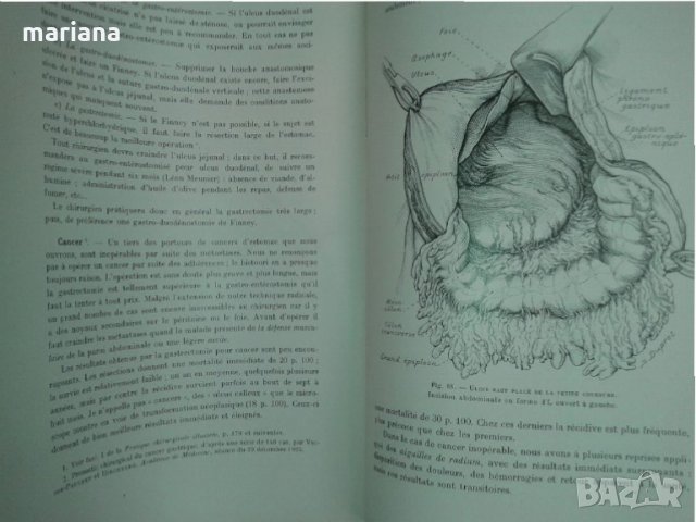 La Pratique Chirurgicale Illustree за бъдещи хирурзи на френски език, снимка 2 - Специализирана литература - 25819887