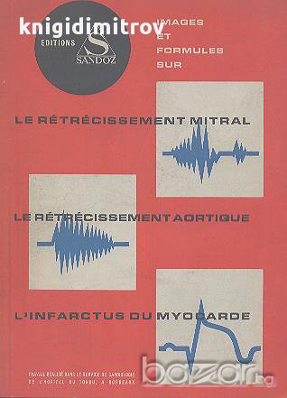 Images et formules sur le retrecissement mitral, le retrecissement aortique, l'infractus du myocarde, снимка 1