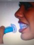  Уред за Професионално Лед избелване на зъби, снимка 1