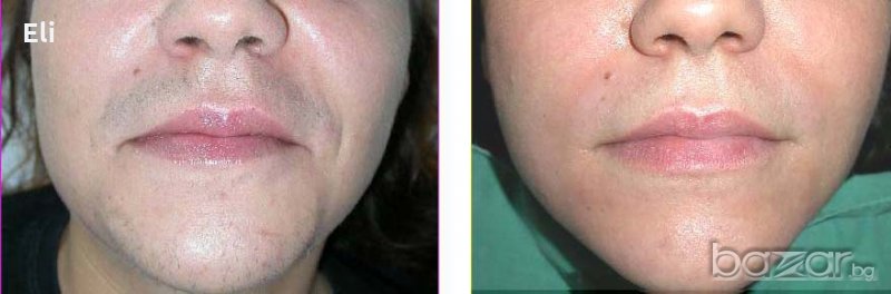 Пилинг,намаляващ окосмяването по лицето и тялото, снимка 1