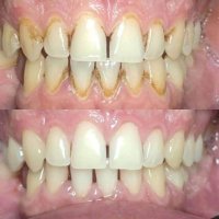 Паста за зъби против зъбен камък с бамбукова сол, снимка 1 - Други - 40398579