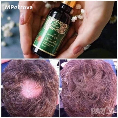 Тоник активатор за растеж на косата