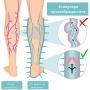 Апарат за венозна тренировка и облекчаване на тежестта в краката , снимка 6