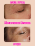 Подмладяващи процедури за лице, шия и ръце, снимка 1