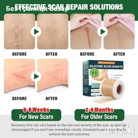 Нови Лепенки против белези – силикон, многократна употреба, безопасни, снимка 2 - Други - 49815364