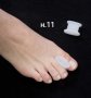 Изпъкнали кокалчета ”hallux valgus”-различни видове, снимка 16