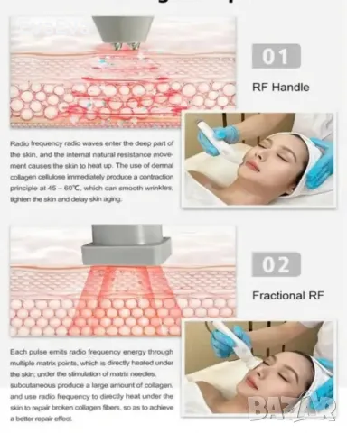 Машина за криотерапия и фракционен РФ, снимка 2 - Козметични уреди - 49479521