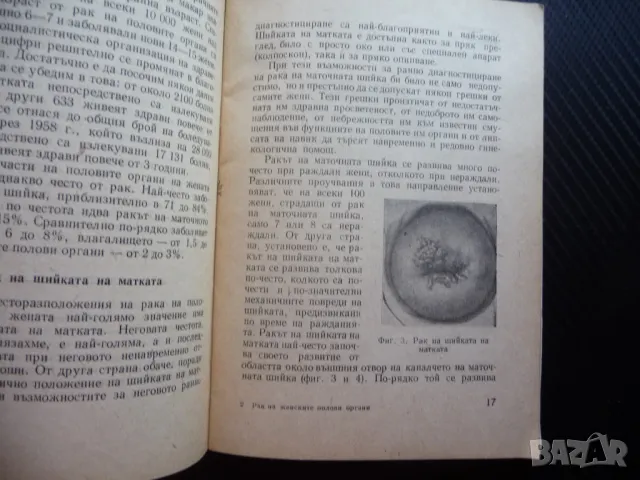Рак на женските полови органи Тодор Ат. Вълков заболявания болести, снимка 2 - Специализирана литература - 49542997