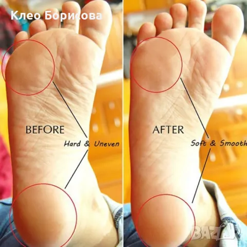 Уред за гладки пети и стъпала Instant Hard Skin Remover, снимка 5 - Други - 49185993