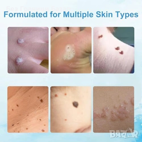 Нов Крем против плантарни брадавици и кожни тагове 20g за лице и тяло, снимка 3 - Козметика за тяло - 53155977