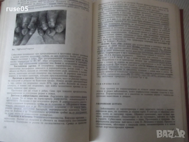 Книга "Дерматология и венерология - Ив. Толев" - 434 стр., снимка 6 - Учебници, учебни тетрадки - 53218698