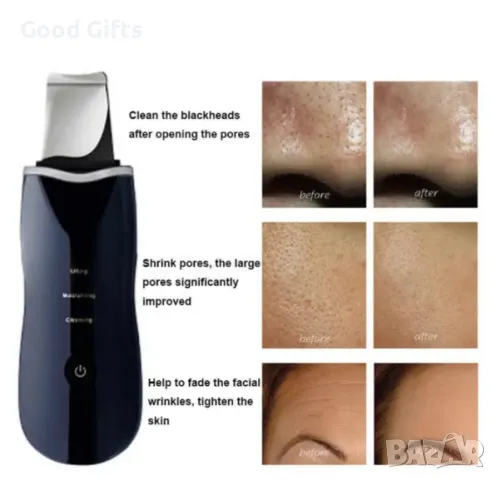 Ултразвукова шпатула за дълбоко почистване на лице, йонофореза, електропорация, снимка 6 - Други - 47512789