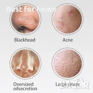 ANLAN Ултразвуков скрубер/ шпатула за кожа 4 в 1, снимка 5 - Козметични уреди - 47326557