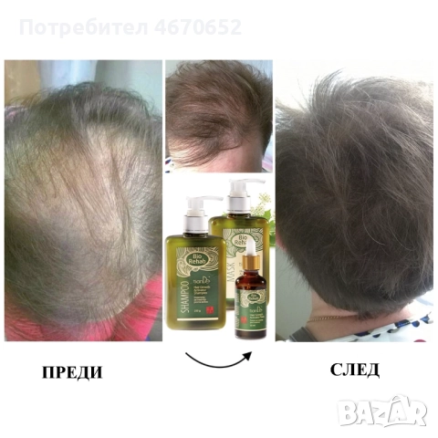 Тоник активатор на растежа „Bio Rehab“, 50 мл, снимка 2 - Продукти за коса - 52716788