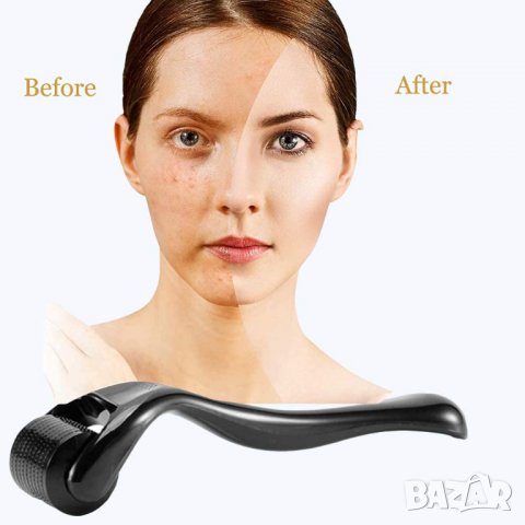 Дерма ролер 540 титаниеви игли, Срещу оплешивяване, Подмладява и регенерира кожата, снимка 6 - Други - 38502058