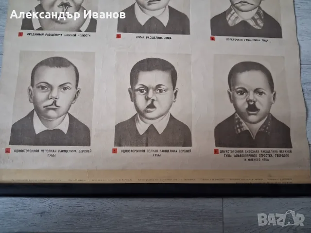 Стара табела,табло "Дефекти на лицето" 1964 г., снимка 4 - Здраве, медицина и спорт - 56138553