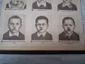 Стара табела,табло "Дефекти на лицето" 1964 г., снимка 4