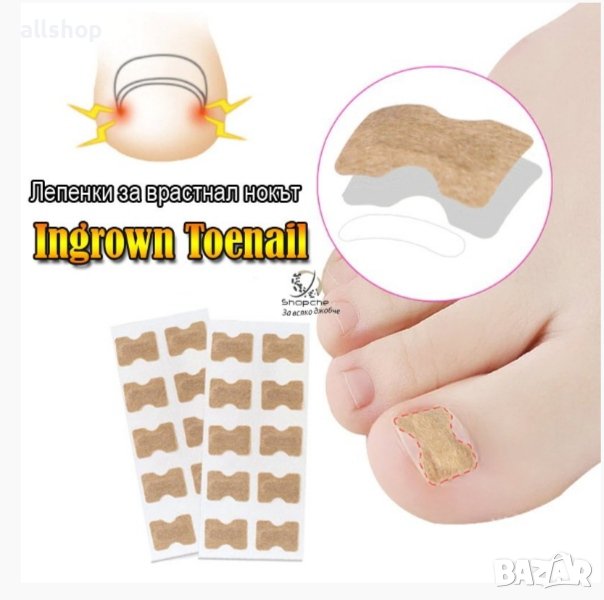 ЛЕПЕНКИ ЗА ВРАСТНАЛ НОКЪТ INGROWN TOENAIL , снимка 1