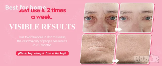 Професионален радиочестотен уред за стягане на кожата - Uaike RF 01, снимка 12 - Козметични уреди - 47327128