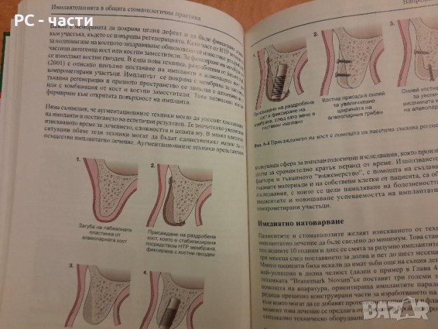 Имплантологията в общата стоматологична практика- Сиърсън, Гауф, Хемингс - 2005г., 102 стр., снимка 6 - Специализирана литература - 42554758