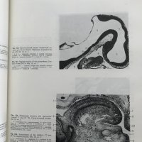 Эмбриология человека Атлас - Л. И. Фалин, снимка 9 - Специализирана литература - 35205923