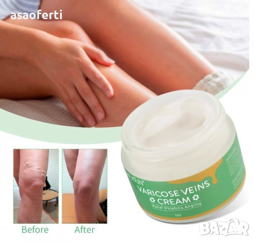 Билков крем за лечение на разширени вени, формула с екстракт от 6 билки, снимка 5 - Други - 39897979