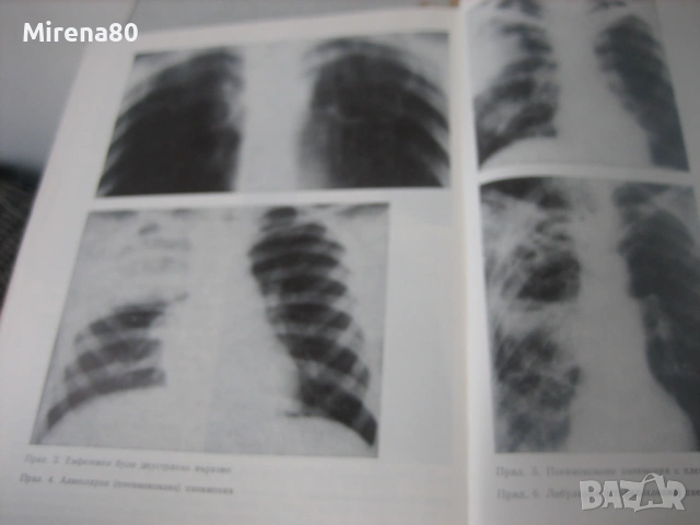 Ръководство по вътрешни болести - том 2, снимка 6 - Специализирана литература - 53966319