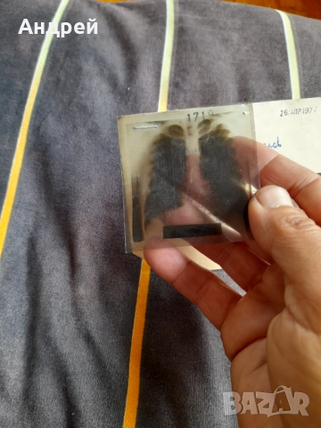 Стара ренгенова снимка 1977, снимка 2 - Колекции - 52296289