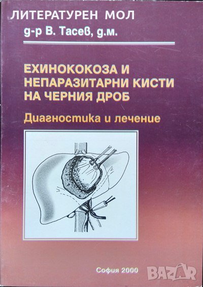 Ехинококоза и непаразитни кисти на черния дроб.  В. Тасев 2000 г., снимка 1