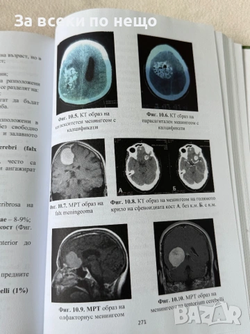 Клинична невроанатомия, снимка 9 - Специализирана литература - 54308036