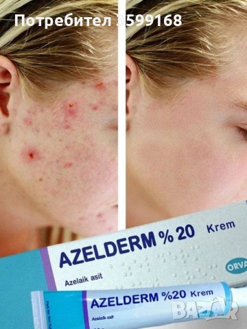 Azelderm 20%