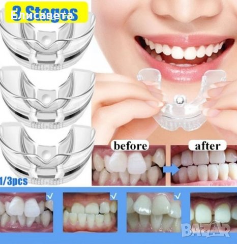 Промо-Невидими брекети -Шини , снимка 8 - Козметика за лице - 35519131