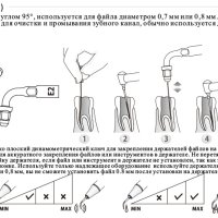 Приставки за ултразвуков скалер Woodpecker, EMS, снимка 1 - Стоматология - 44356782