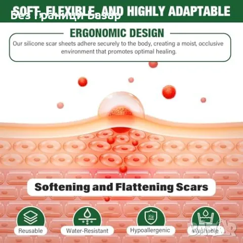 Нови Лепенки против белези – силикон, многократна употреба, безопасни, снимка 4 - Други - 49815364