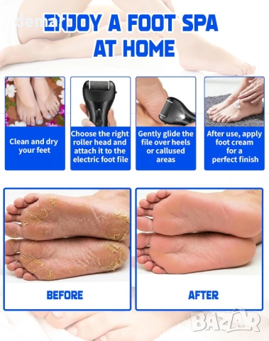 Електрическа пила за премахване на твърда кожа и мазоли за крака, 3 ролки, снимка 9 - Електрически пили за пети - 54108453
